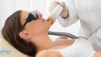 إزالة الشعر الزائد